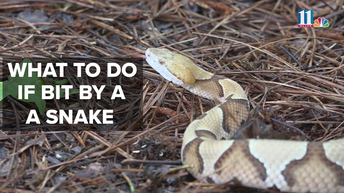 What To Do If You Are Bitten By A Snake Wmaz