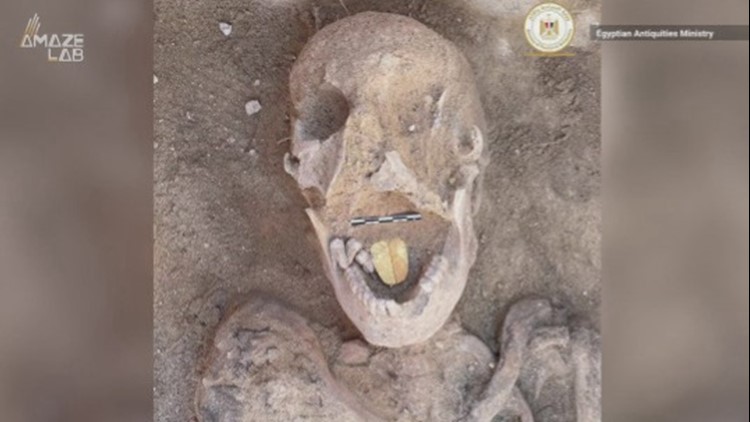 This 2,000-Year-Old Mummy Has This Very Odd Feature