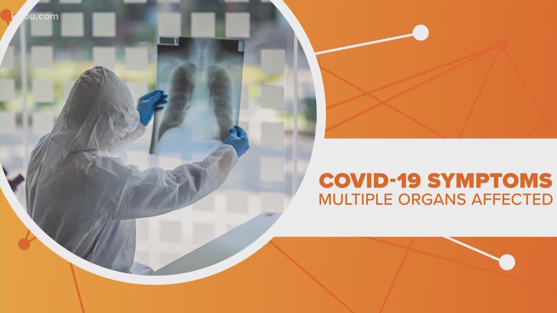 Health experts now have evidence a coronavirus diagnosis could come with long-term side effects. Let's connect the dots.