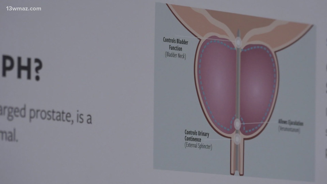 'Completely stopped up': Elderly man returns to normal life after prostate procedure