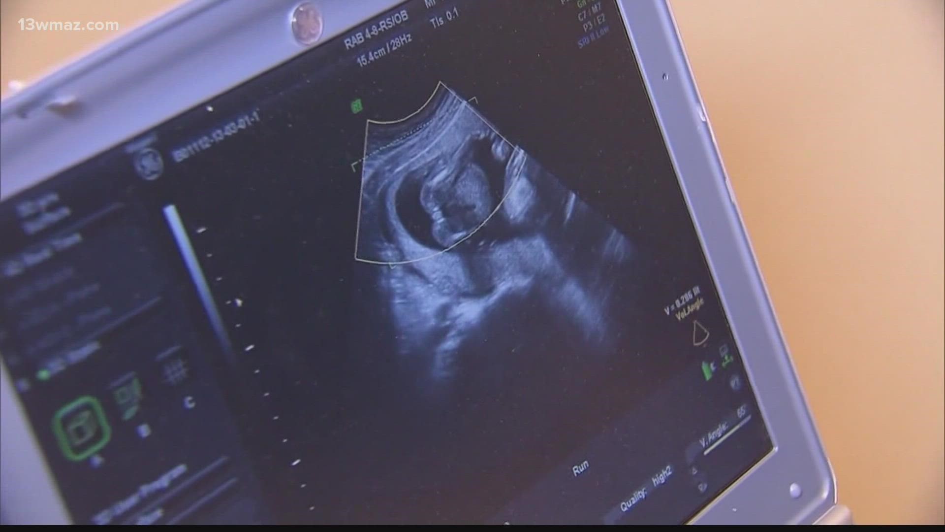 40 percent of the people who filled out our 13WMAZ Listening Lab survey in October said abortion is one of the top issues they want to hear politicians address.