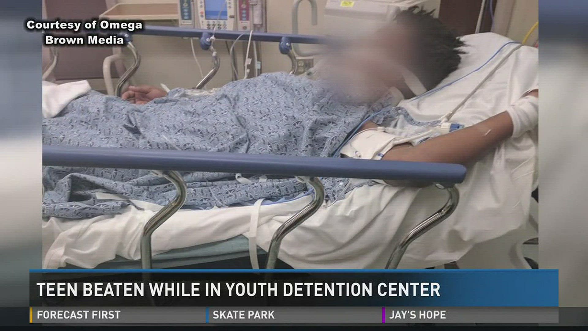 Teen beaten while in youth detention center