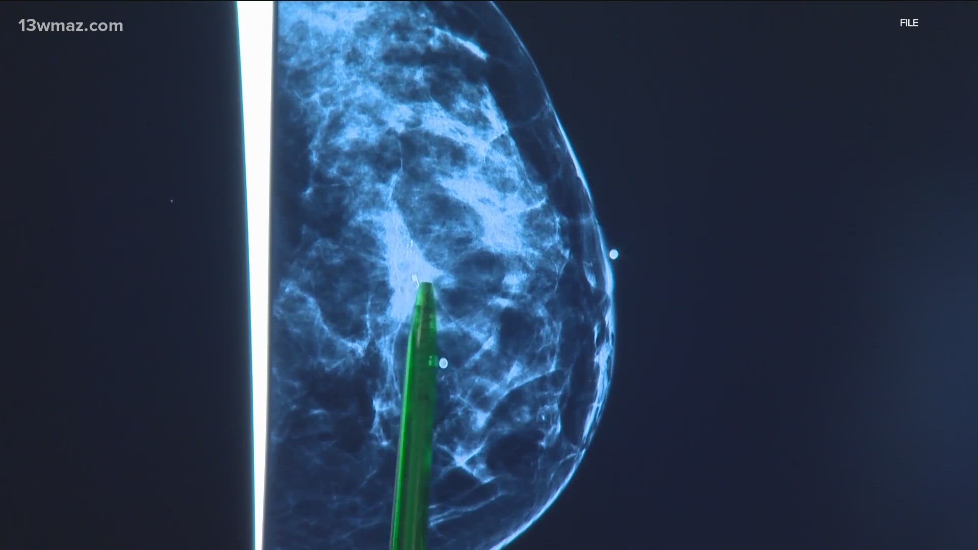 According to the CDC, 1 in 8 women will get breast cancer in her life
