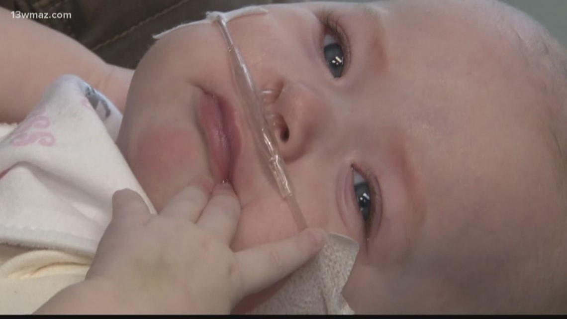 A Warner Robins 6-month-old is able to go home for the first time after doctors received a humanitarian exemption from the FDA for a rare surgery