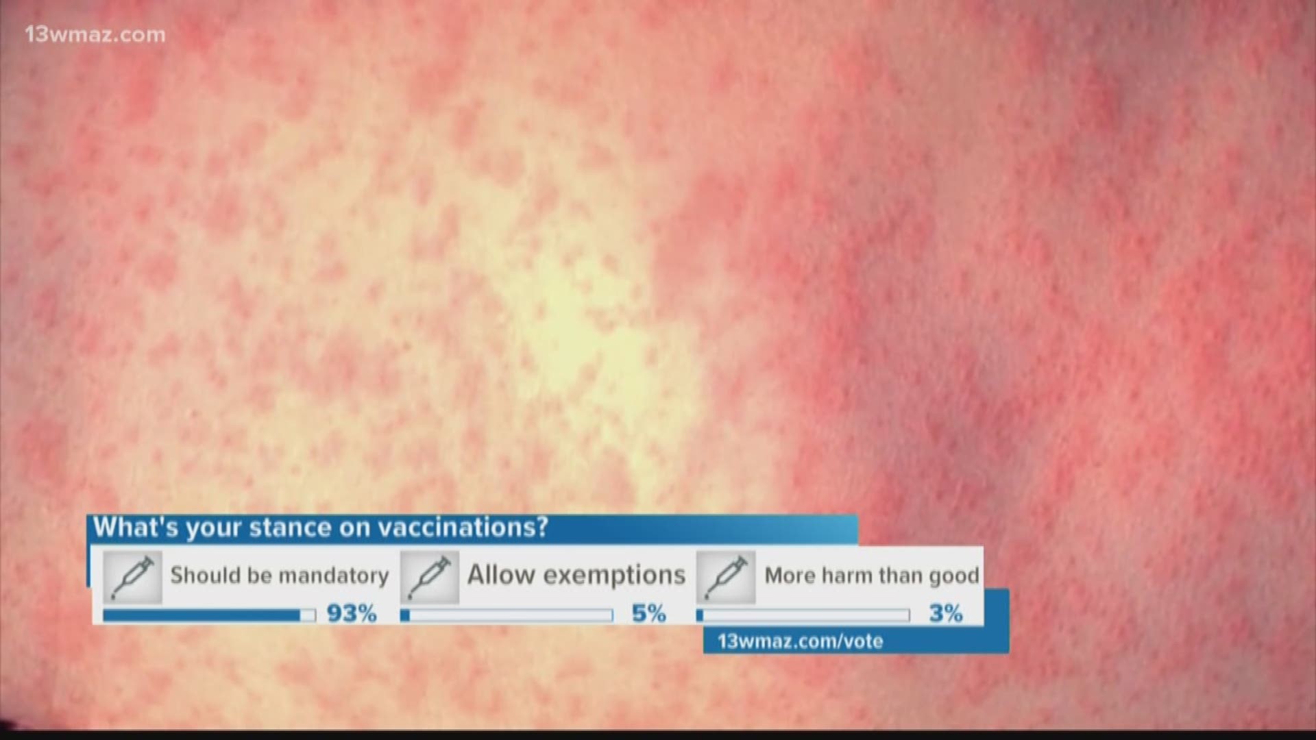 3 measles cases reported in Ga.