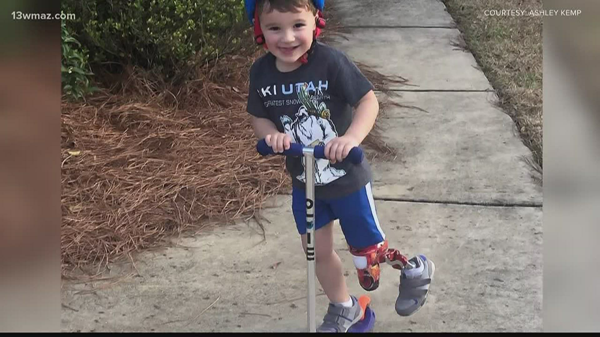 A Warner Robins youngster won't let his "little leg" slow him down. Sarah Hammond introduces us to 3-year-old Charlie Kemp.