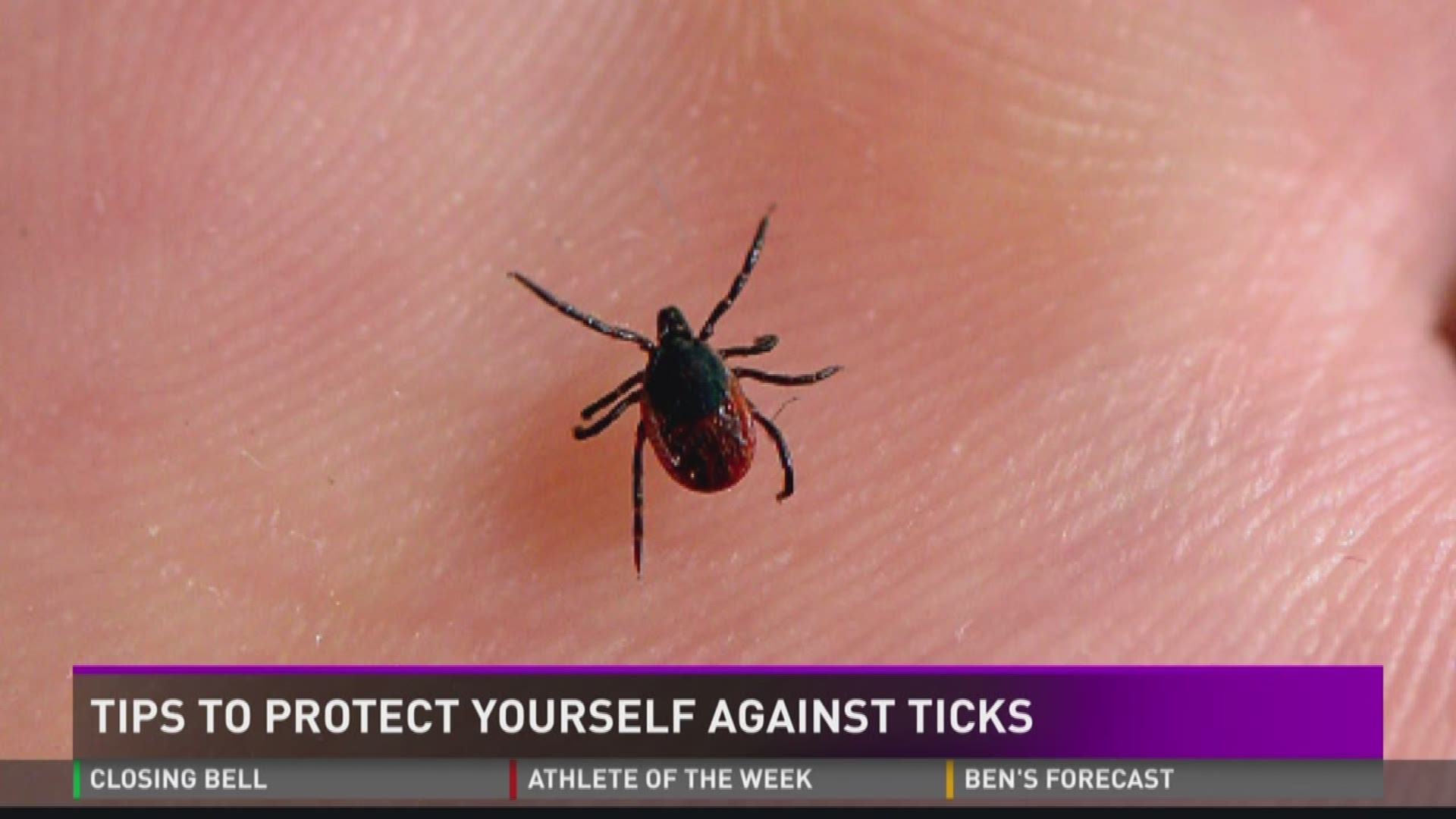 Tips for battling ticks this summer