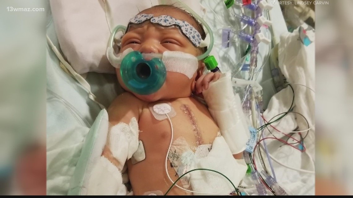 Warner Robins 1-year-old gears up for third open heart surgery
