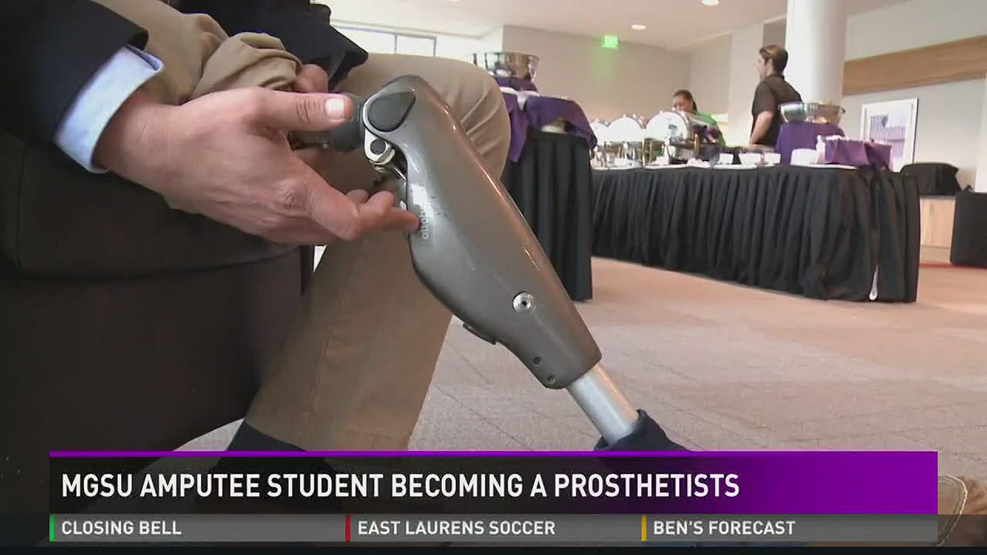 MGSU amputee student becoming a prosthetist