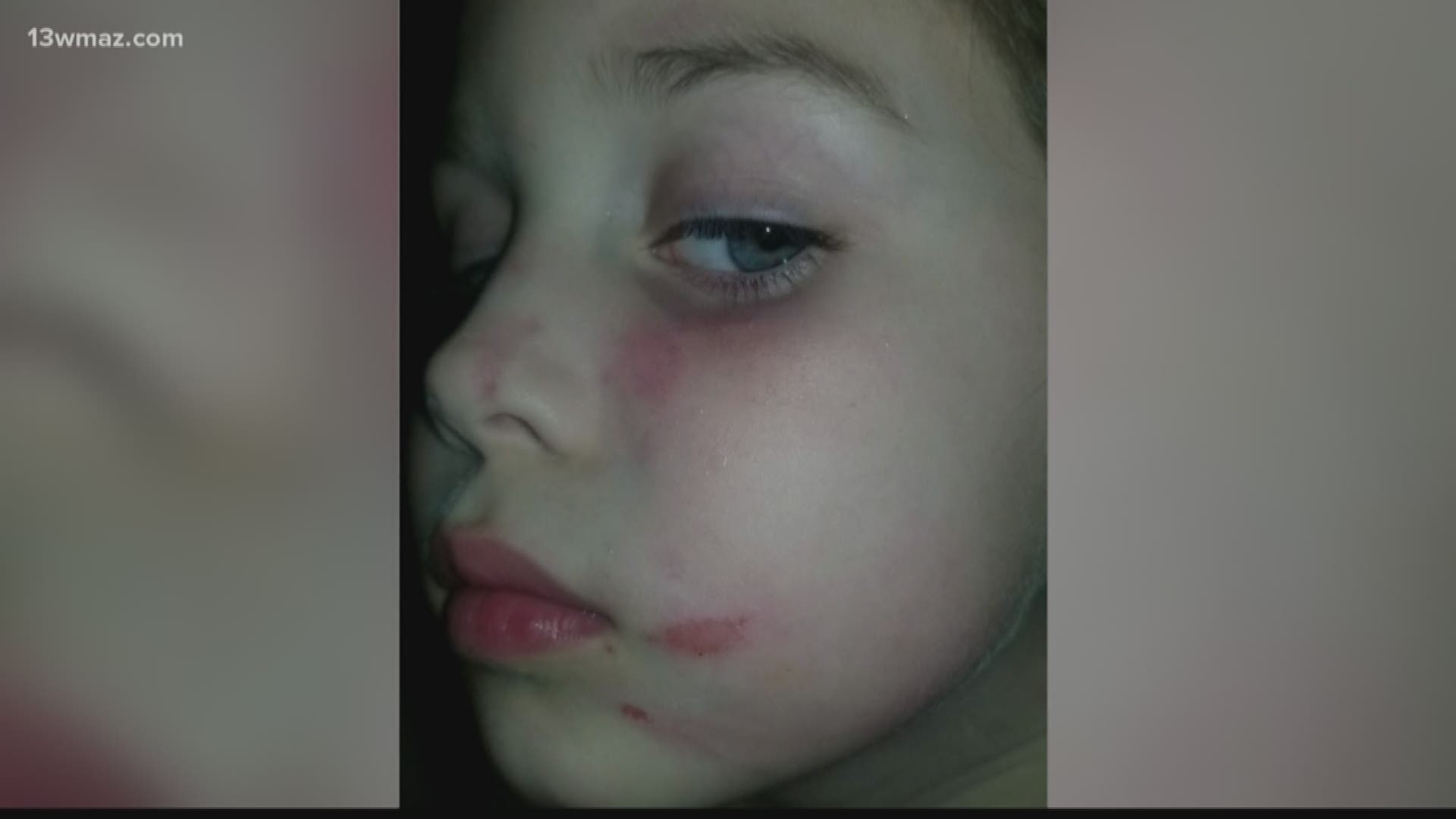 Charges are pending against a 12-year-old after they allegedly attacked a Monroe County 5-year-old on a December bus ride home