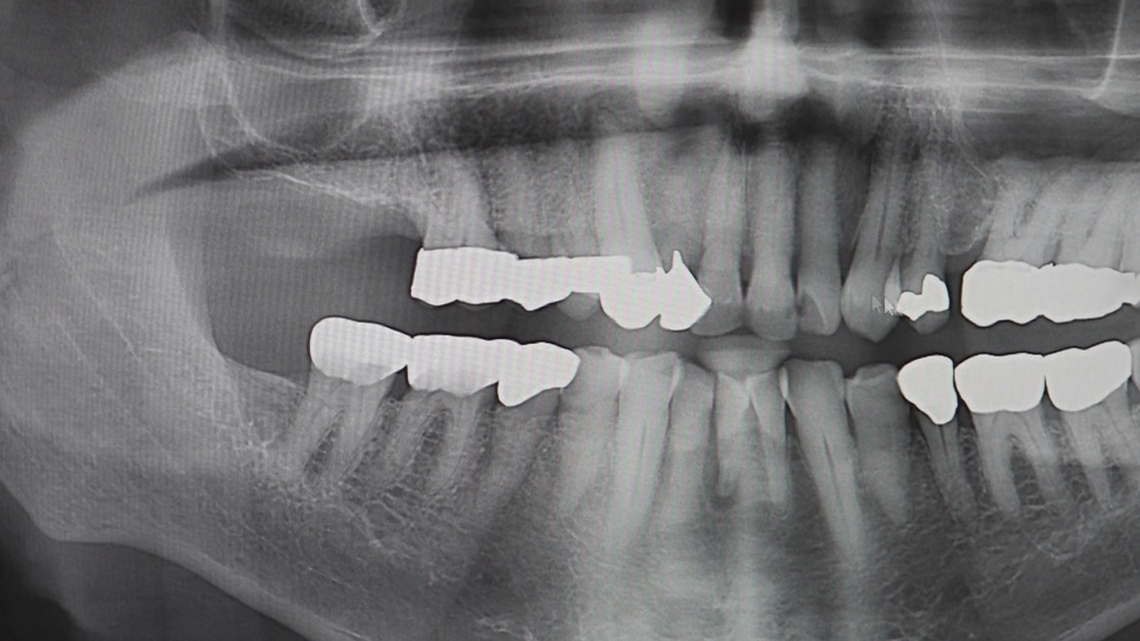 Georgia dentists can now see you through your phone — here's how the new teledentistry law works