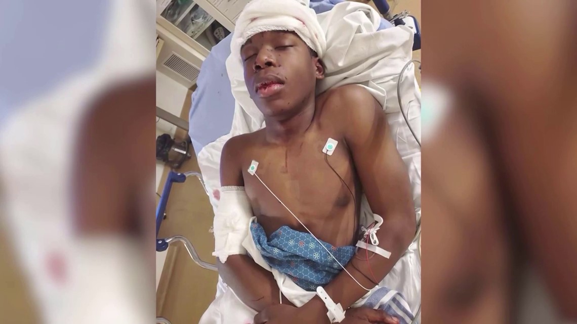 Ralph Yarl shooting: Black teen shot after going to wrong house - Vimarsana News