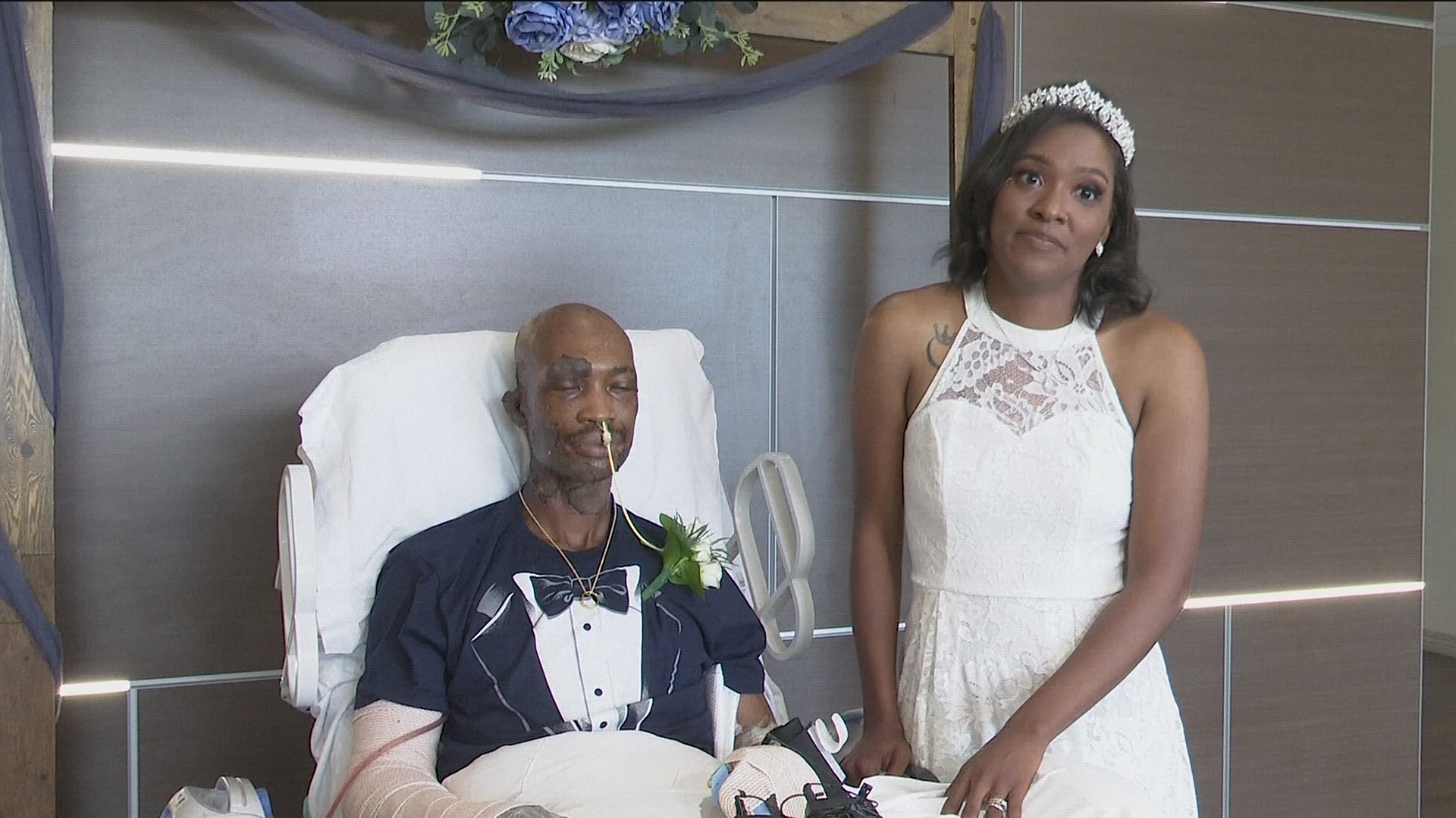 Tanesha and Preston Cobb had an untraditional wedding after the groom experienced chemical burns on nearly a third of his body.