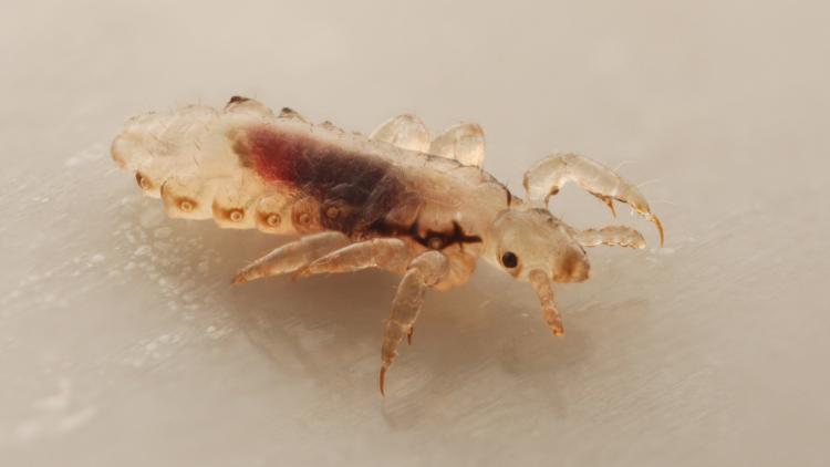 American Academy of Pediatrics issues new guidance on kids with lice