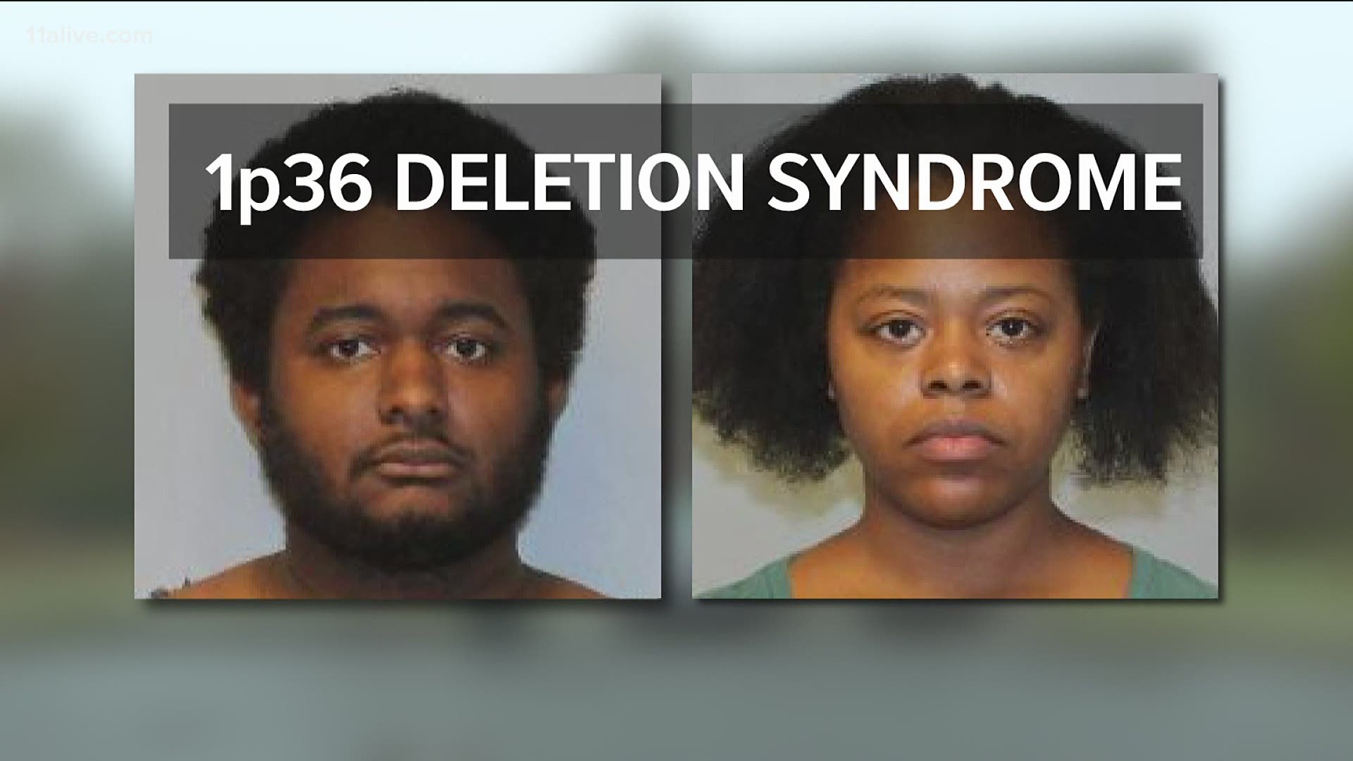The attorney for Jerrail and Porscha Mickens told 11Alive on Friday the 5-year-old girl suffered from a rare chromosome disorder that led to her death.