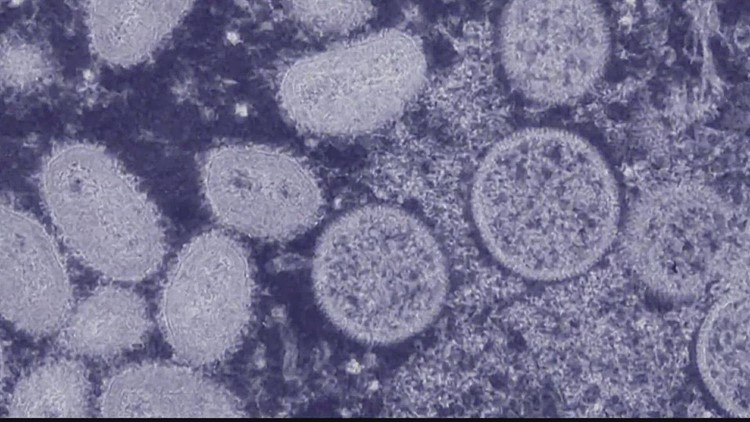 Georgia surpasses 1,000 monkeypox cases