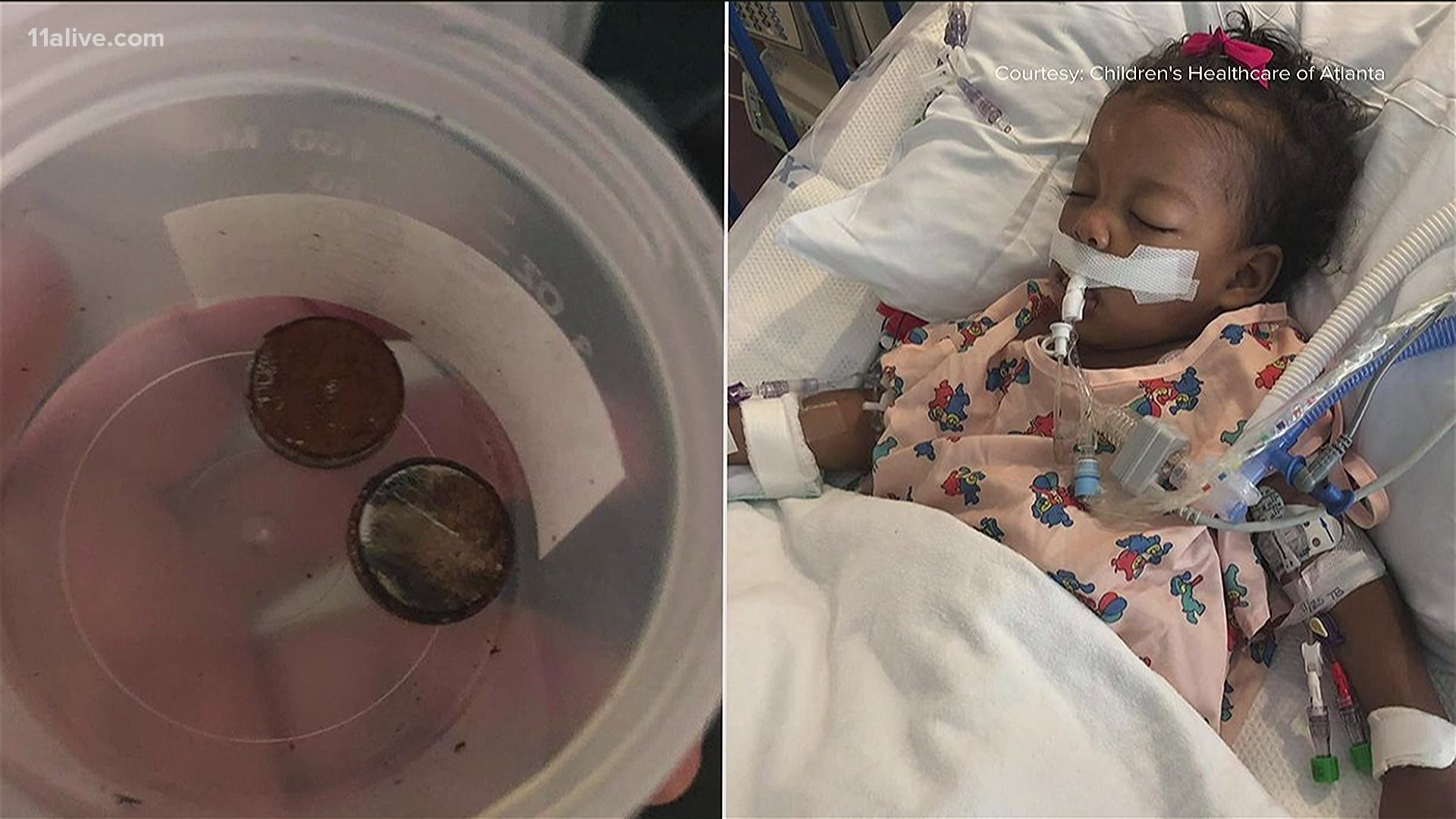 Children's Healthcare of Atlanta warns of button battery dangers