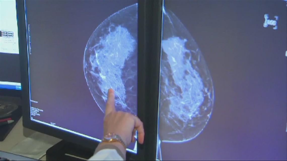 Do not skip routine healthcare with COVID-19, including mammograms